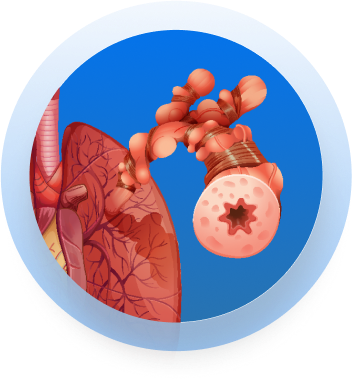 Asthmatic Lung